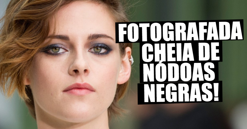 Kristen Stewart Aparece Em P blico Com N doas Negras Na Cara kristen-stewart-aparece-em-p-blico-com-n-doas-negras-na-cara