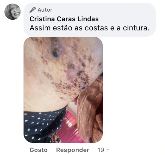 cristina-caras-lindas-herpes