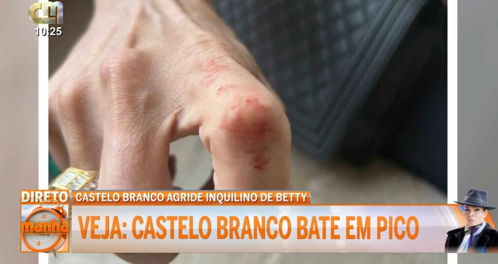 Novas imagens! José Castelo Branco ferido após agressões com Pedro Pico