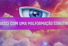 Secret Story 8 - O segredo 'Nasci com uma malformação congénita' pertence a…