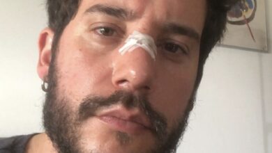 Ricardo de Sá foi brutalmente agredido