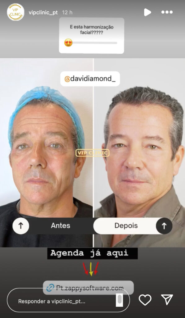 David Diamond faz procedimento estético. Vê o antes e o depois!