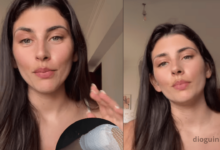 Joana Schreyer sofreu acidente  e deixa joelhos esfolados. Ex Reality show conta tudo