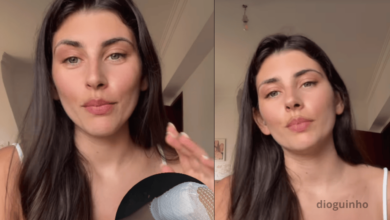 Joana Schreyer sofreu acidente  e deixa joelhos esfolados. Ex Reality show conta tudo