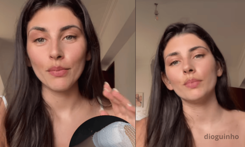 Joana Schreyer sofreu acidente e deixa joelhos esfolados. Ex Reality show conta tudo