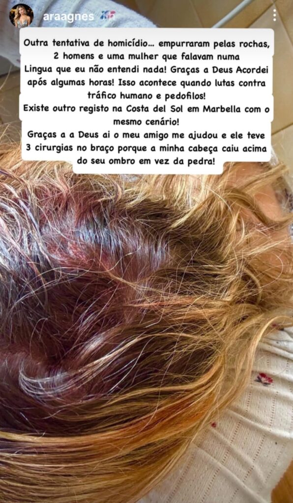 CHOQUE! Agnes Arabela Marques faz denúncia: "Outra tentativa de homicídio"