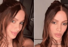 As alterações que Anitta fez ao rosto! Imagens e dados tecnicos