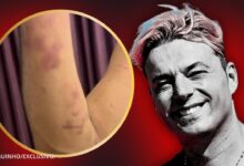 BOMBÁSTICO! Sérgio Rossi: "Providência cautelar a Ana Rita para devolver recheio da casa de 50 mil euros". VEJA AS FOTOS DA VIOLÊNCIA DOMÉSTICA