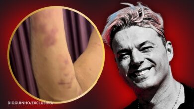 BOMBÁSTICO! Sérgio Rossi: "Providência cautelar a Ana Rita para devolver recheio da casa de 50 mil euros". VEJA AS FOTOS DA VIOLÊNCIA DOMÉSTICA