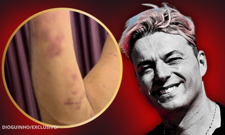 BOMBÁSTICO! Sérgio Rossi: "Providência cautelar a Ana Rita para devolver recheio da casa de 50 mil euros". VEJA AS FOTOS DA VIOLÊNCIA DOMÉSTICA
