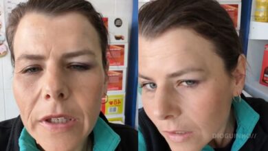 Surreal: Noélia Pereira já foi trabalhar e desmaiou: "Desmaiei e bati com o olho no chão"