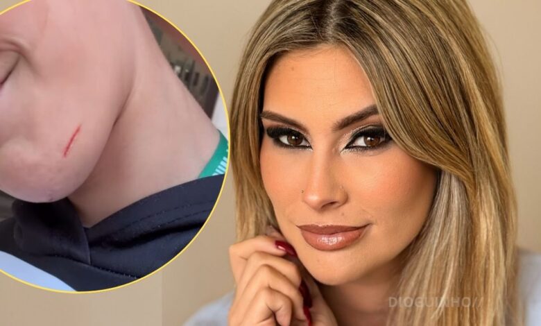 Bernardina Brito revoltada após agressão aos filhos no ATL