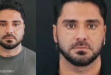 A mudança no rosto do Cantor Leandro após procedimento estético