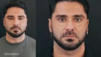 A mudança no rosto do Cantor Leandro após procedimento estético