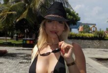 Susto de saúde: Ex-concorrente Cátia Basílio submetida a cirurgia mamária de urgência!