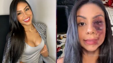 Influenciadora brasileira acusada de inventar agressões para ganhar seguidores