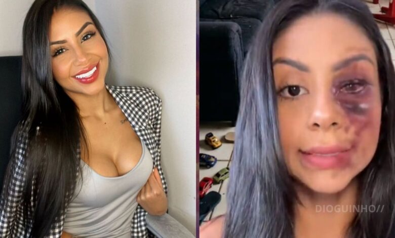 Influenciadora brasileira acusada de inventar agressões para ganhar seguidores