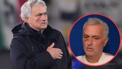 José Mourinho visto com hematoma na cara durante partida do Real Madrid. Revelado o motivo!