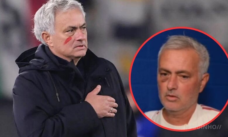 José Mourinho visto com hematoma na cara durante partida do Real Madrid. Revelado o motivo!
