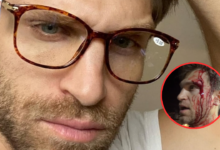Astro de 'Pretty Little Liars' vive momentos de terror: Keegan Allen assaltado à mão armada (VÍDEO)