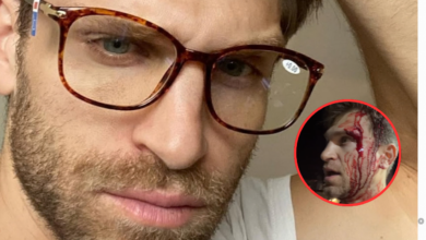 Astro de 'Pretty Little Liars' vive momentos de terror: Keegan Allen assaltado à mão armada (VÍDEO)