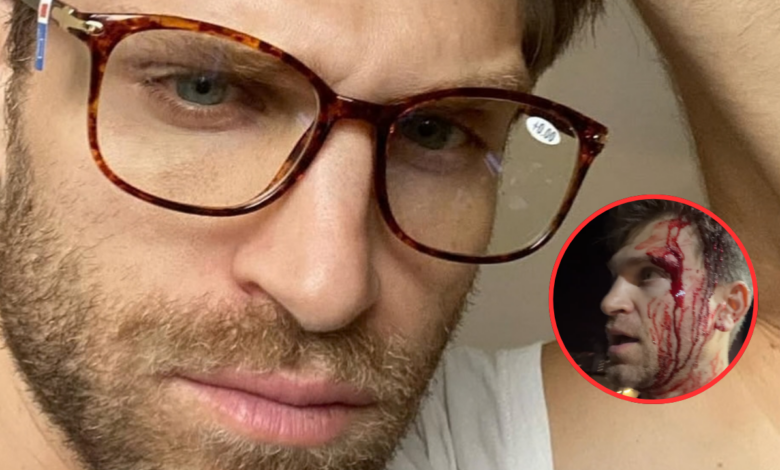Astro de 'Pretty Little Liars' vive momentos de terror: Keegan Allen assaltado à mão armada (VÍDEO)