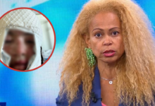 Atacada com ácido pelo ex-namorado: Francisca de Magalhães Barros expõe ciclo de violência em Amarante