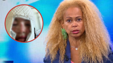 Atacada com ácido pelo ex-namorado: Francisca de Magalhães Barros expõe ciclo de violência em Amarante