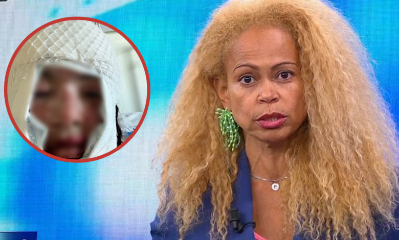 Atacada com ácido pelo ex-namorado: Francisca de Magalhães Barros expõe ciclo de violência em Amarante
